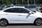 Hyundai Accent 2017 1.6 Sedan MT White For Sale -1