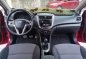 =Hyundai Accent 2014 Hatchback at 30000 km for sale-4