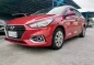 2020 Hyundai Accent  1.4 GL 6AT in Pasay, Metro Manila-1